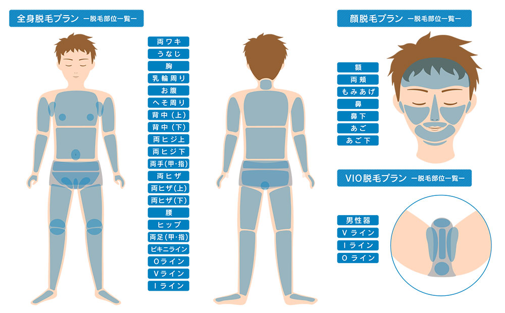脱毛部位開設図
